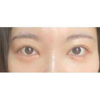 after image