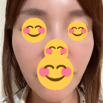 after image