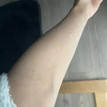 after image