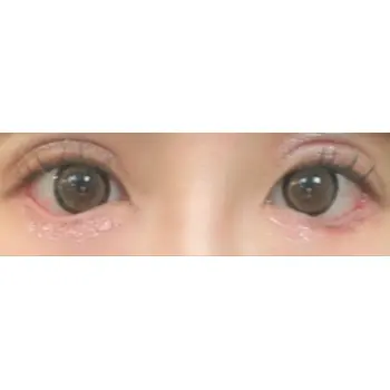 after image