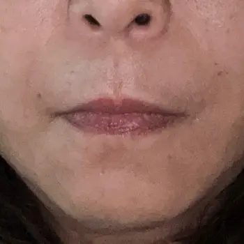after image