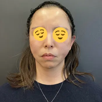 after image