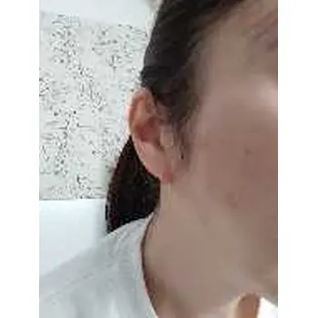 after image