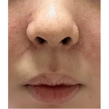 after image