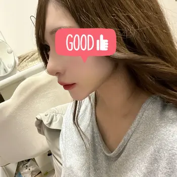 after image