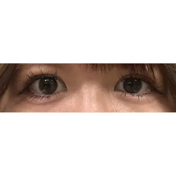 after image