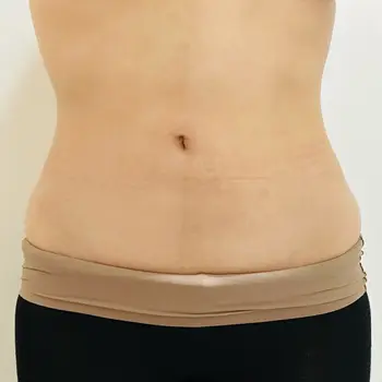 after image