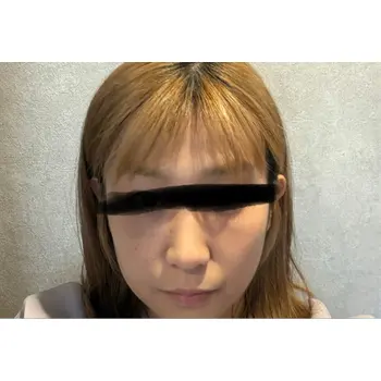 after image