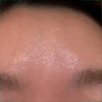 after image