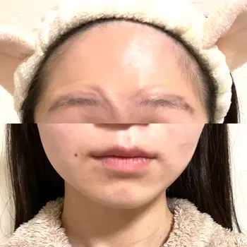after image