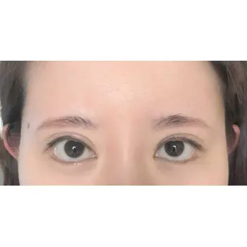 after image