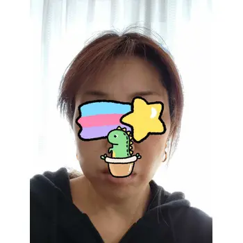 after image