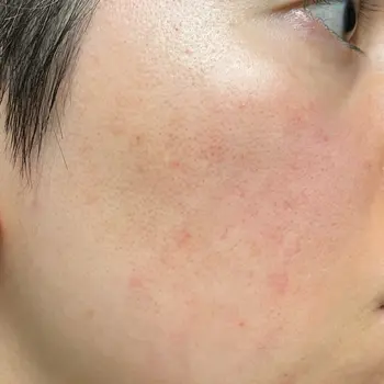after image