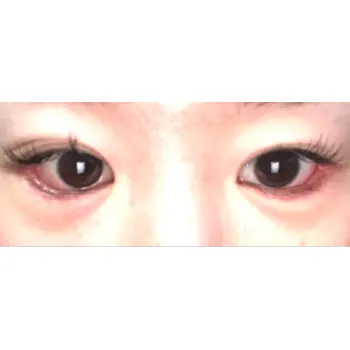 after image