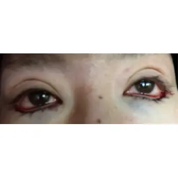 after image