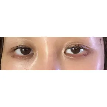 after image