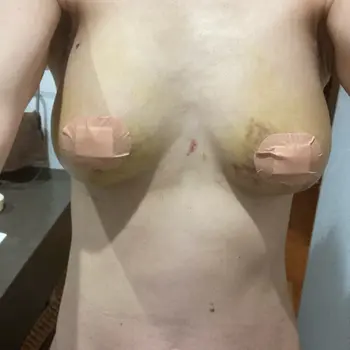 after image