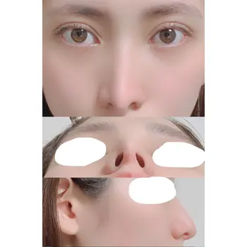after image