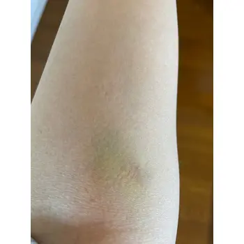 after image