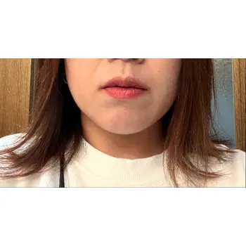 after image