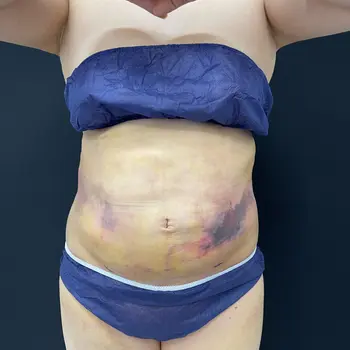 after image