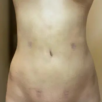 after image