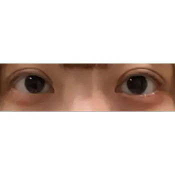 after image