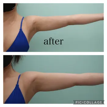 after image