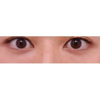 after image