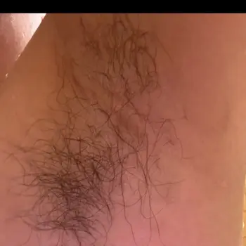 after image