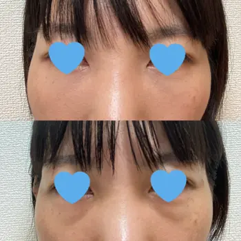 after image