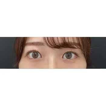 after image