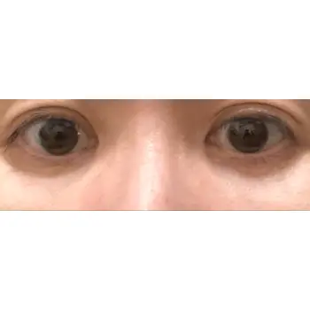 after image