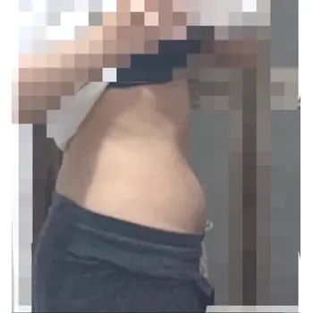 before image