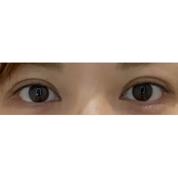 before image
