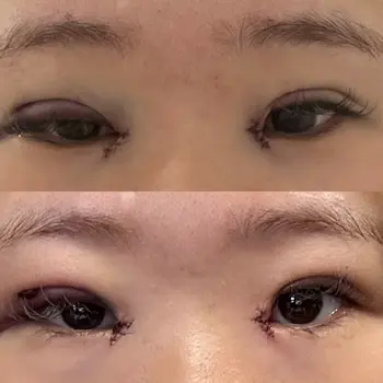 before image