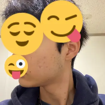 before image