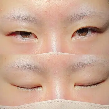 before image