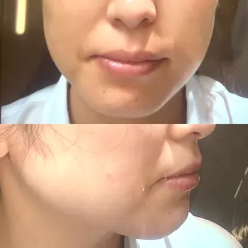 before image