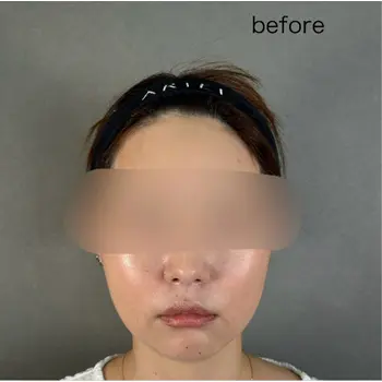 before image