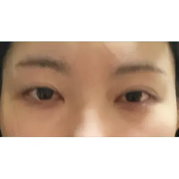 before image