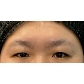 before image