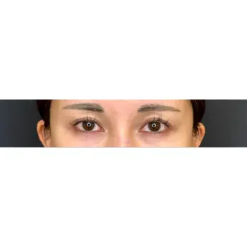 before image