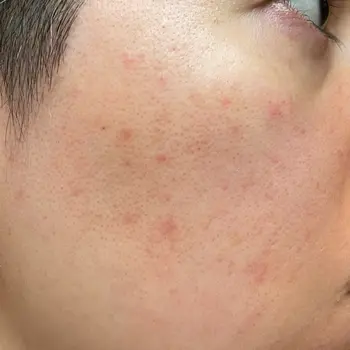 before image