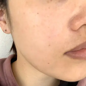 before image
