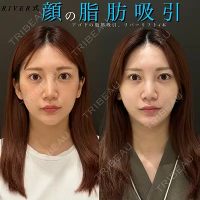 RIVER CLINIC（リバークリニック） 戸田 貴之医師の症例