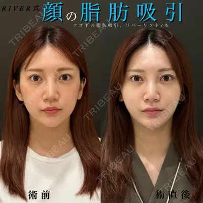 RIVER CLINIC（リバークリニック） 戸田 貴之医師の症例