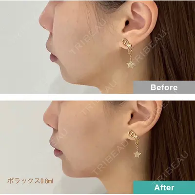 DMTC CLINIC 日本橋院 松井泉医師の症例