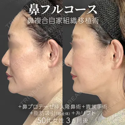 ジョウクリニック 銀座院 重本　譲医師の症例