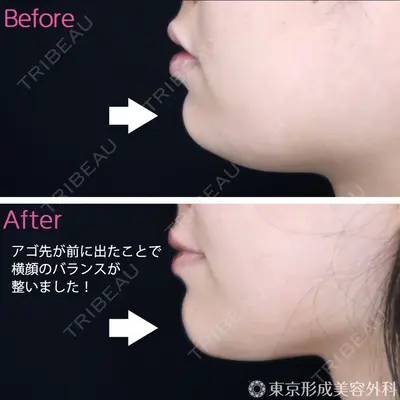 東京形成美容外科 船橋院 山崎 修吾医師の症例